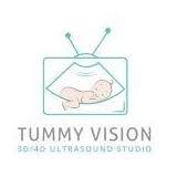 tummyvision
